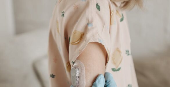 A novel use of wearable technology and artificial intelligence to advance treatment in Anorexia Nervosa