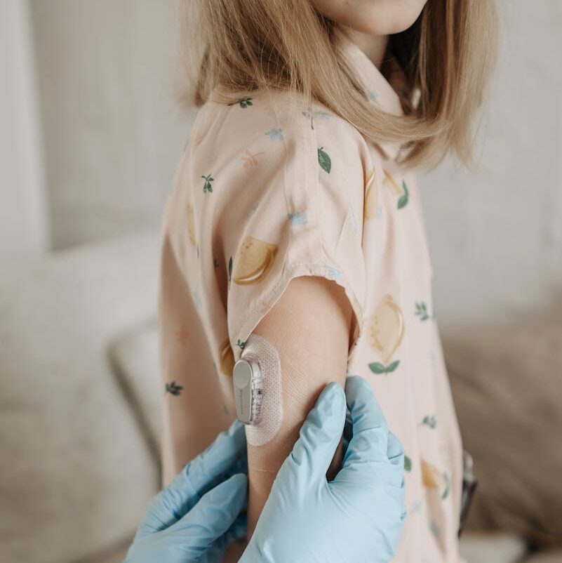 A novel use of wearable technology and artificial intelligence to advance treatment in Anorexia Nervosa